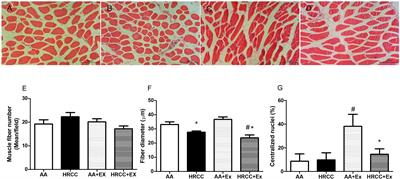 Physical Exercise−Mediated Changes in Redox Profile Contribute to Muscle Remodeling After Passive Hand-Rolled Cornhusk Cigarette Smoke Exposure